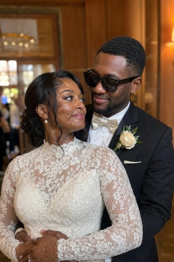 I Married a Blind Man So He’d Never See My Scars – On Our Wedding Night, He Said, ‘You Need to Know the Truth I’ve Been Hiding for 20 Years’